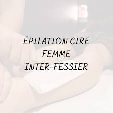 Epilation du Sillon Inter-fessier image